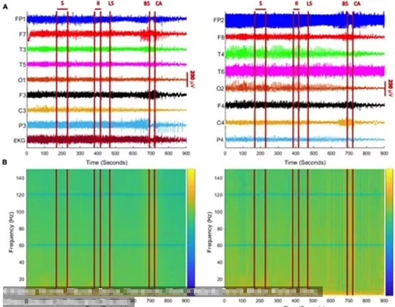صورة رقم 3 - آخر 30 ثانية قبل مفارقة الحياة.. ماذا رأى المحتضرون العائدون من الموت؟ صورة رقم 3 - آخر 30 ثانية قبل مفارقة الحياة.. ماذا رأى المحتضرون العائدون من الموت؟