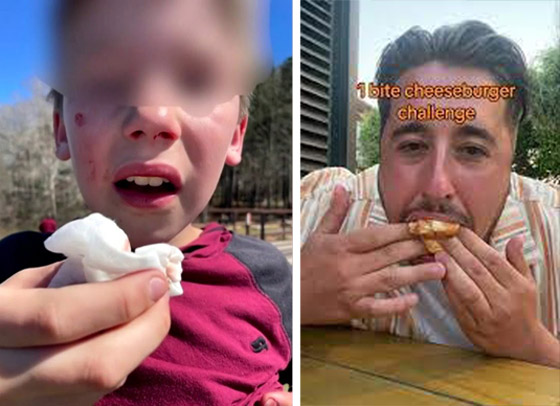 قصص مأساوية بسبب تحديات (تيك توك) من استنشاق مواد خطيرة للحرق والغرق والوفاة! صورة رقم 1 قصص مأساوية بسبب تحديات (تيك توك) من استنشاق مواد خطيرة للحرق والغرق والوفاة! صورة رقم 1