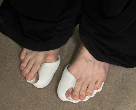 صورة رقم 13 - بالصور: أغرب صيحات الأحذية المبتكرة في عالم الموضة صورة رقم 13 - بالصور: أغرب صيحات الأحذية المبتكرة في عالم الموضة