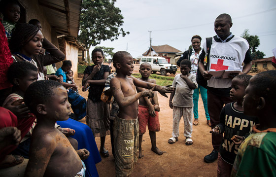 المرض الغامض يُرعب الأطباء.. يقتل ضحاياه بـ48 ساعة وهذه عوارضه صورة رقم 4 المرض الغامض يُرعب الأطباء.. يقتل ضحاياه بـ48 ساعة وهذه عوارضه صورة رقم 4
