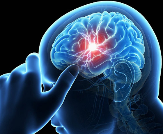 مش بس الصداع.. 4 علامات تحذيرية مبكرة لأورام المخ لا تتجاهلها صورة رقم 3