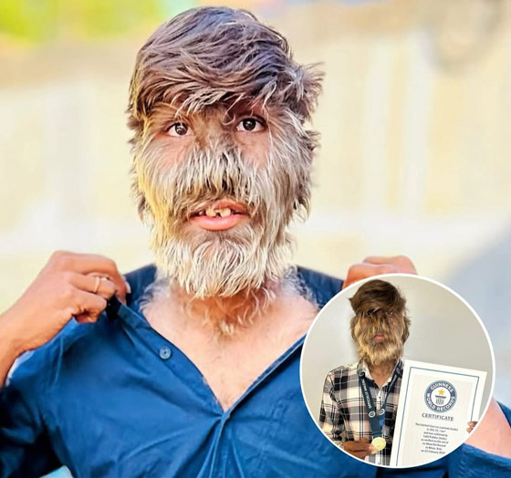 شاب هندي يدخل موسوعة غينيس بسبب 