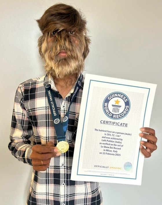 شاب هندي يدخل موسوعة غينيس بسبب 