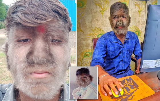 شاب هندي يدخل موسوعة غينيس بسبب 