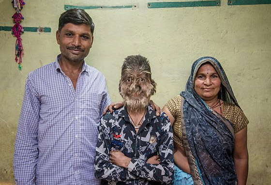 شاب هندي يدخل موسوعة غينيس بسبب 