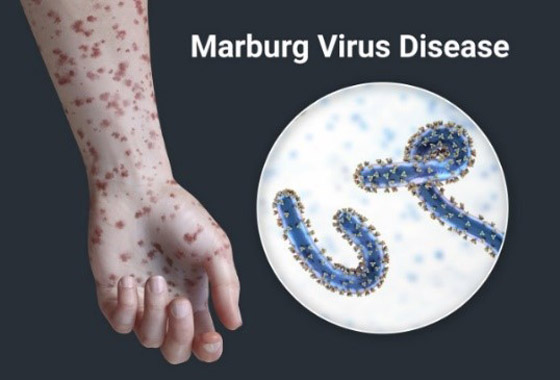 صورة رقم 1 - كيف تنتقل الفيروسات من الحيوانات إلى البشر؟ صورة رقم 1 - كيف تنتقل الفيروسات من الحيوانات إلى البشر؟