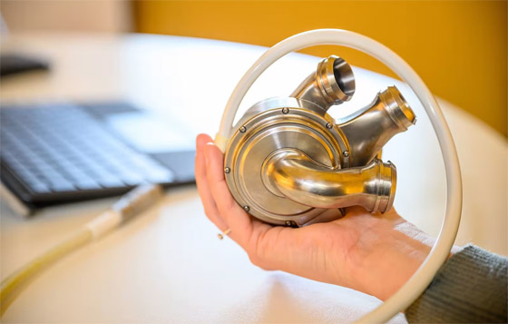 قلب تيتانيوم اصطناعي يُبقي رجلا أستراليا على قيد الحياة 100 يوم.. صور صورة رقم 1