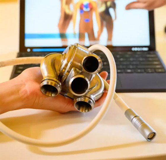 قلب تيتانيوم اصطناعي يُبقي رجلا أستراليا على قيد الحياة 100 يوم.. صور صورة رقم 5