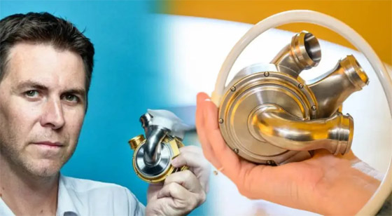 قلب تيتانيوم اصطناعي يُبقي رجلا أستراليا على قيد الحياة 100 يوم.. صور صورة رقم 9