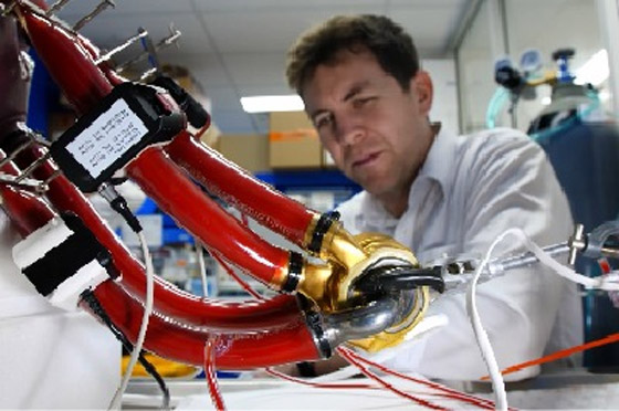 قلب تيتانيوم اصطناعي يُبقي رجلا أستراليا على قيد الحياة 100 يوم.. صور صورة رقم 7