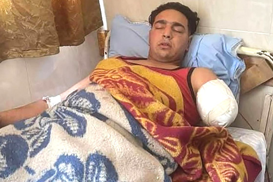  ���� ��� 1 - ��� ���� �� ���� ���� �� ���