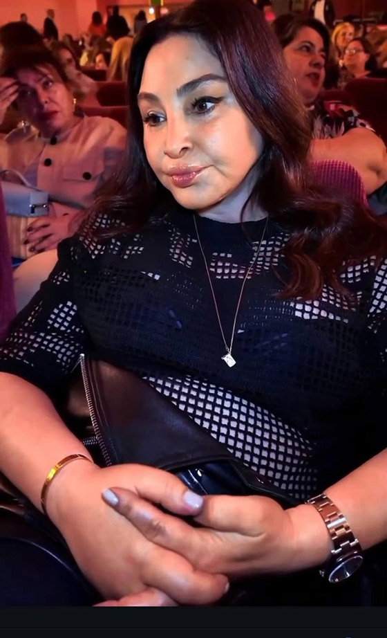 إليسا بظهور صادم بمسرحية كارول سماحة! عملية تجميل فاشلة ام مرض؟ وكيف انتهى الخلاف بين النجمتين؟ صورة رقم 4