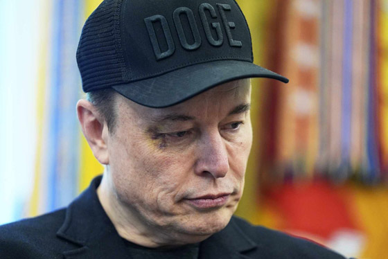 ماسك عن كدمة عينه: إكس فعلها.. لم أكن بالقرب من فرنسا صورة رقم 1