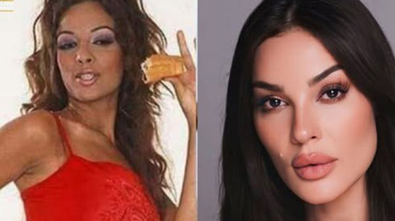 صورة قديمة لـ نادين نجيم تصدم جمهورها! شكلها مختلف تماما واتهامات بعمليات تجميل ونادين ترد: ما كنت بعرف حط ميك آب! صورة رقم 2 صورة قديمة لـ نادين نجيم تصدم جمهورها! شكلها مختلف تماما واتهامات بعمليات تجميل ونادين ترد: ما كنت بعرف حط ميك آب! صورة رقم 2