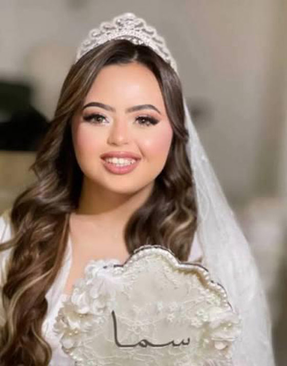 جوري بكر ترفض زواج ذوي الاعاقة.. والعروس سما رامي (داون سيندروم) ترد بسخرية هي وأمهاً صورة رقم 4
