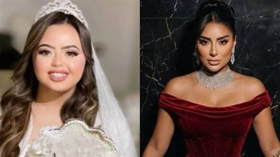 جوري بكر ترفض زواج ذوي الاعاقة.. والعروس سما رامي (داون سيندروم) ترد بسخرية هي وأمهاً صورة رقم 7