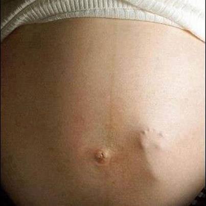 ����� �� ��������