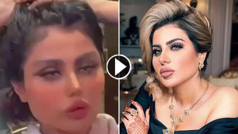 صور وفيديو حليمة بولند المنتفخ يثير التساؤلات.. شاهدوها قبل وبعد عمليات التجميل!