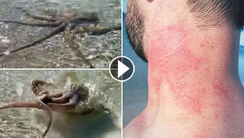أخطبوط غاضب يشن هجوما مرعبا.. التف حول رقبة وظهر أسترالي! فيديو
