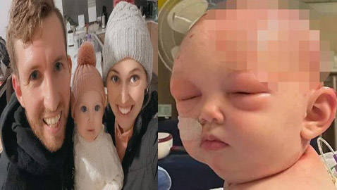 صور: طفلة تصاب بالعمى جرّاء مجفف الشعر وبحروق شديدة.. شعرها قد لا ينمو من جديد 