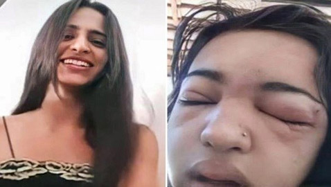 تفارق الحياة بعدوى قاتلة بسبب غرس حلقة في حاجبها
