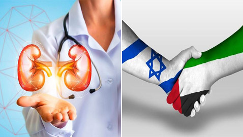 صفقة تبرع وتبادل كلى بشرية بين إماراتي وإسرائيلية