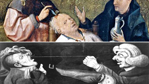 تعرفوا إلى أغرب العلاجات الطبية على مر التاريخ