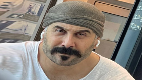 قصي خولي يثير الجدل بتغير ملامحه.. هل خضع لعملية تجميل لتعريض الفك؟
