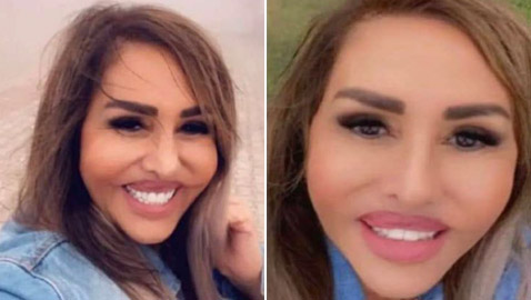 صور صادمة: الفنانة مها المصري بوجه مشوه بعد عملية تجميل جديدة والجمهور: يكسر ايدين الدكتور!