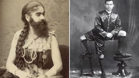 9 نجوم لسيرك (بارنوم) اشتهروا بسماتهم الغريبة: رجل بـ3 أرجل وامرأة ملتحية