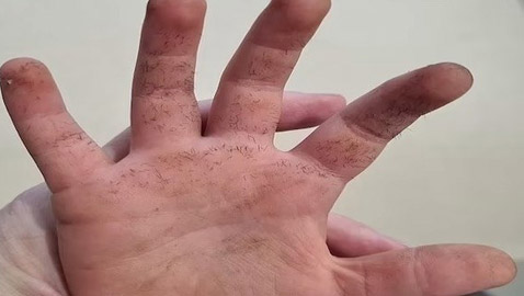 شرنقة شائكة تكاد تقتل طفلاً أثناء لعبه في حديقة المنزل