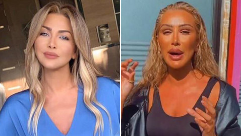 6 ‏نجمات غيرت عمليات التجميل ملامحهن وشوهتها.. صور قبل وبعد