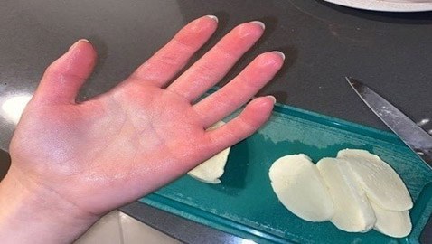 تعاني من حساسية شديدة تجاه البرد يمكن أن تتسبب بوفاتها