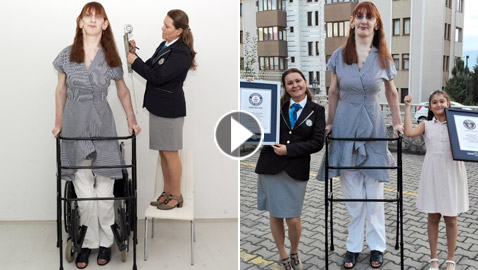 تركية تدخل موسوعة غينيس كأطول امرأة في العالم، ورسالتها: تقبلوا أنفسكم!