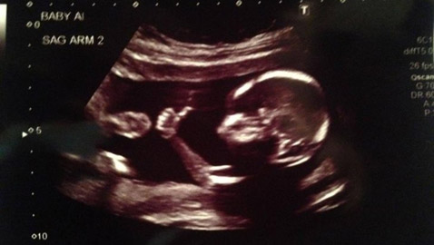 لقطات طريفة سترسم الابتسامة على وجهك: عليك بمشاهدتها