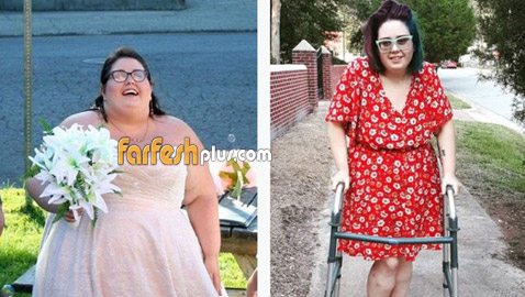تفقد كليتها خلال محاولة خسارة الوزن
