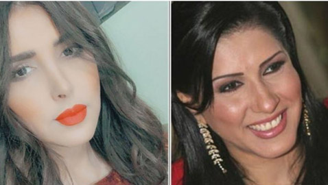 نجمات الخليج قبل وبعد التجميل  صور صادمه :