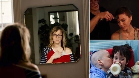 توثق رحلتها مع سرطان الثدي بصور واقعية يومية