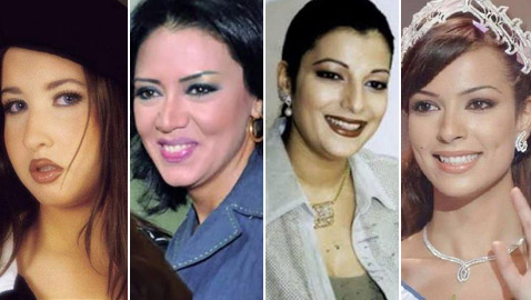 صور قبل وبعد: 15 فنانة اعترفن بإجراء عمليات تجميل غيرت شكلهن كليا