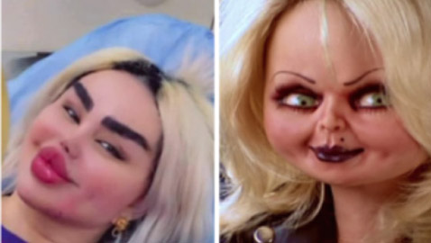 صور صادمة: داليا نعيم بعد عملية تجميلية، شفاهها مخيفة والجمهور: فيلم الرعب!!