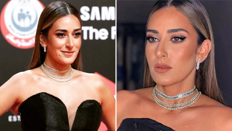 صور أمينة خليل قبل وبعد: هل أجرت عملية تجميل جديدة في أنفها؟