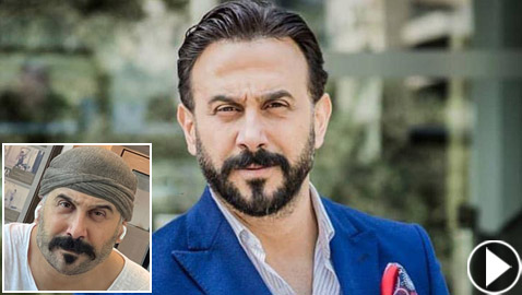 قصي خولي يكشف حقيقة اجرائه عملية تجميل بـ90 ألف دولار.. فيديو