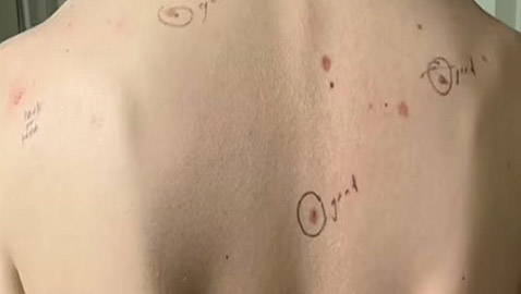 طبيب يدون ملاحظاته على جسم مريضه