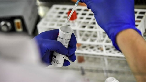 اعتقال رجل عرض عينات من كورونا للبيع على الإنترنت