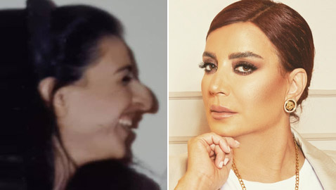 شكران مرتجى ترد ردا ناريا على متنمر سخر من أنفها قبل التجميل