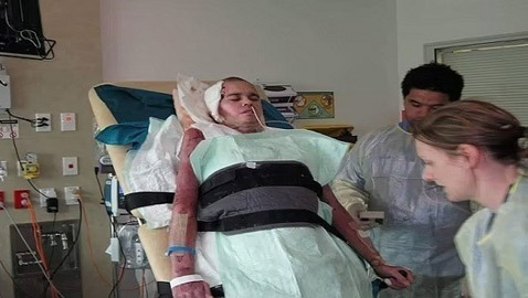 يتعافى بأعجوبة من صدمتين كهربائتين عنيفتين