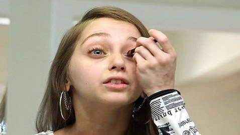 عشرينية تبدو وكأنها بعمر طفلة في الثامنة بسبب حالة نادرة