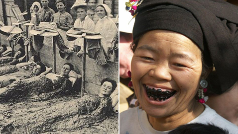 تسويد الأسنان والاستحمام بالبراز: أغرب أشياء قامت بها الفتيات لاكتساب الجمال! 