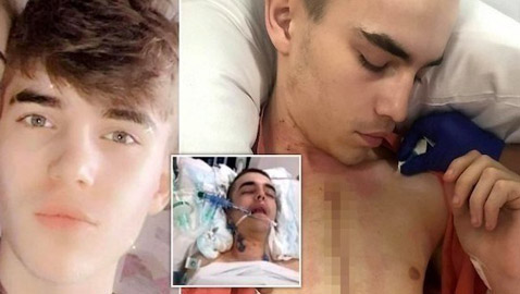 يخرج من منزله بعد عامين من العزلة.. فيتعرض للطعن