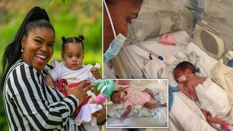 طفلة ولدت في الشهر الخامس من الحمل تحتفل بعيد ميلادها الأول